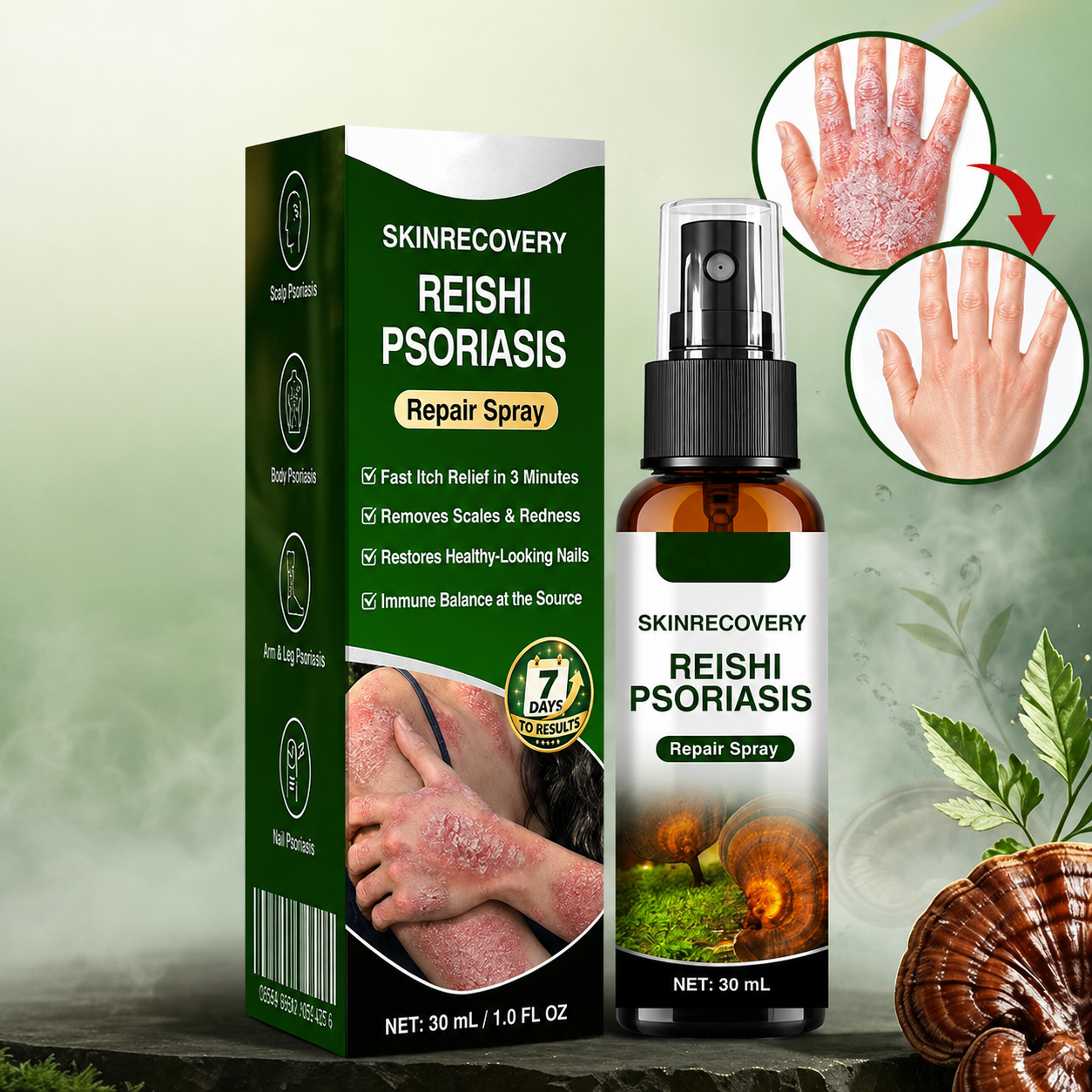 🇺🇸🏆👨⚕️✅SkinRecovery Reishi Psoriasis Repair Spray