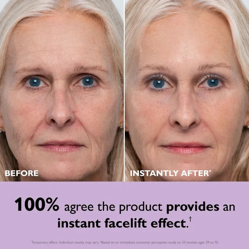 Instant facelift before and after