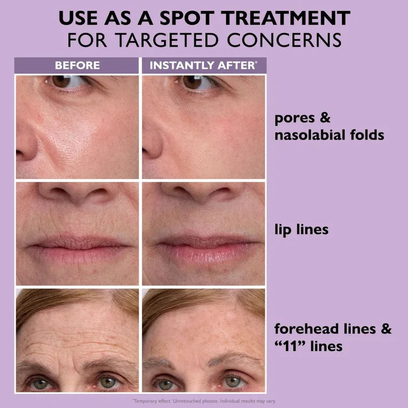 Targeted spot treatment results