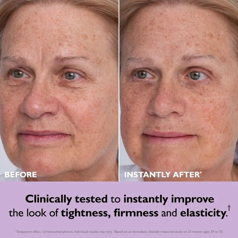 Firmness and elasticity before and after